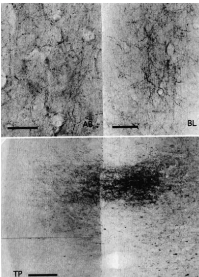 Fig. 4. Representative photomicrographs of nerve terminals and cells labeled by biotinylated dextran amine injected into the medial prefrontal cortex