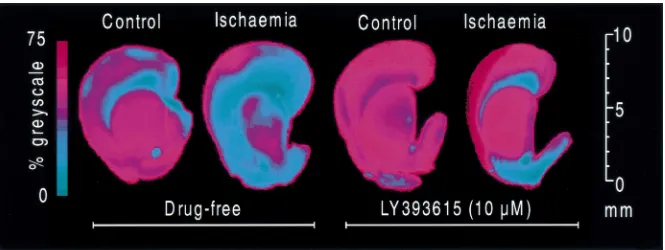 Fig. 2. Representative greyscale scans showing TTC staining of the striatum and cortex in control and ischaemia-treated slices, alone and in the presence of LY393615 (10 mM)