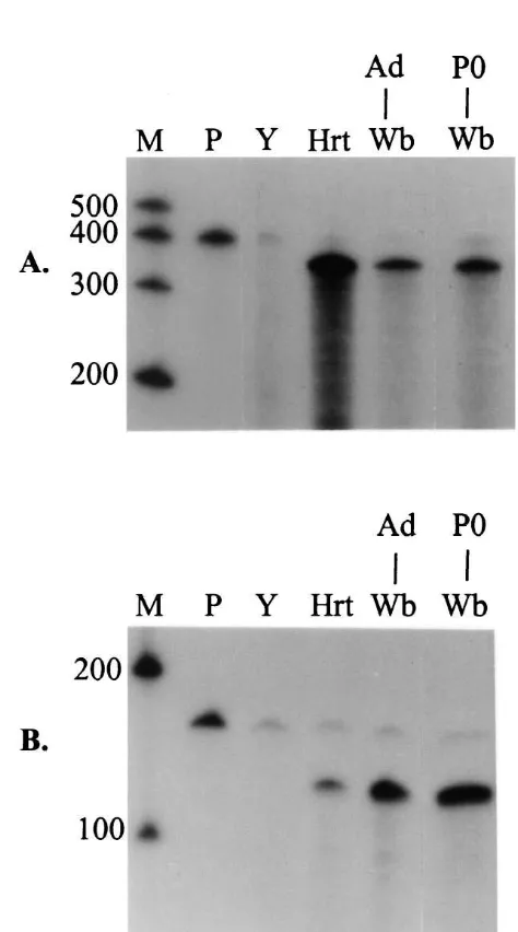 Fig. 1. RNase protection assays of RH-I/SkM2 and cytoplasmic actin.Lane designations: M, markers; P, probe; Y, yeast; Hrt, adult rat heart; Ad,total RNA from adult rat heart was used as a positive control