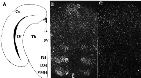 Fig. 3. In situ hybridization of the RH-I/SkM2 rat cardiac sodium channel in the diencephalon of P0 rats