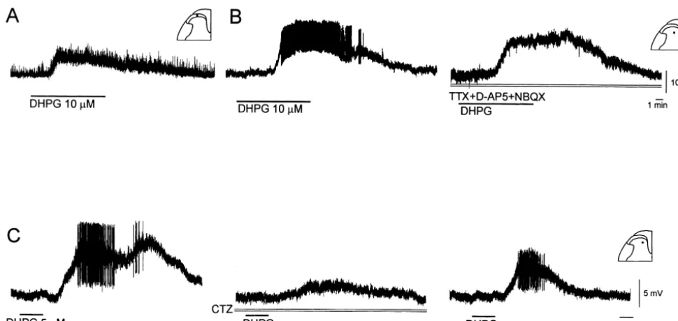 Fig. 7. Sthe baseline noise in both superﬁcial (A) and deep (B) DH neurons. In the deep DH neuron the larger depolarization was associated with spontaneousaction potential ﬁring (B, left trace)