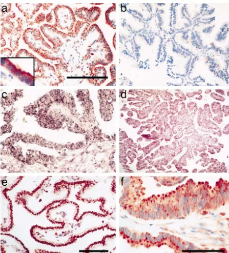 Fig. 1. Immunohistochemical staining of normal CP with antibodies to human STC (a), and with STC antibodies preabsorbed with recombinant STCprotein as a control (b)