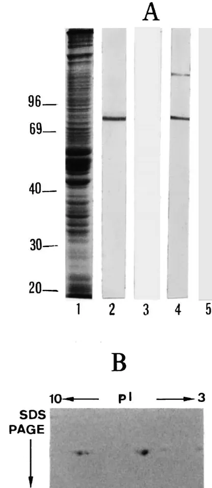 Fig. 1. Cd-immunoreactivity on Western blots. (A) Some 50-m(lanes 2 and 3) and gizzard Cd (lanes 4 and 5) antibodies