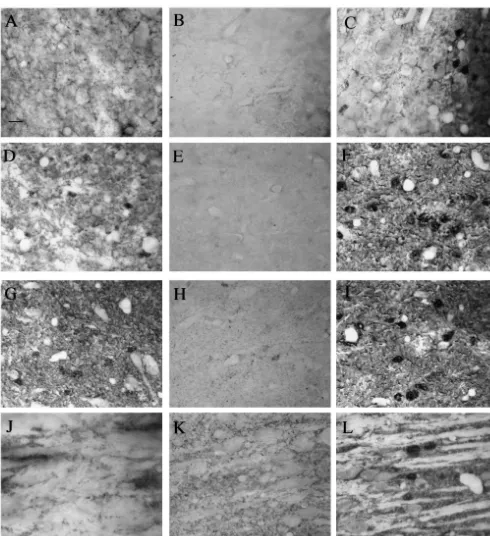 Fig. 1. GABA immunolabelling in the brain of allylnitrile-treated mice (84 mg/kg) at 0 (A,D,G and J), 2 (B,E,H and K), and 14 (C,F,I and L) dayspostdosings