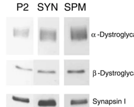Fig. 1. Representative blot images from the crude membrane ‘P2’fraction, synaptosomes (SYN), and synaptosomal membranes (SPM),respectively, for immunoblots with various antibodies as shown