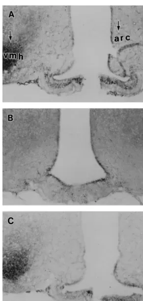 Fig. 2. Photomicrographs showing the effect of fasting and leptin repletion on NADPH-d reactivity in the ventromedial hypothalamus (VMH) and arcuatenucleus (ARC)