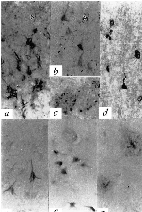 Fig. 5. Immunohistochemistry for CRP (a–d) and AP (e–g). Sectionswere formic acid treated and stained with polyclonal anti-CRP antibody(a–c), ethanol-ﬁxed and treated with 5G4 MAB (d), or parafﬁn embeddedand treated with the polyclonal anti-AP antibody (e–