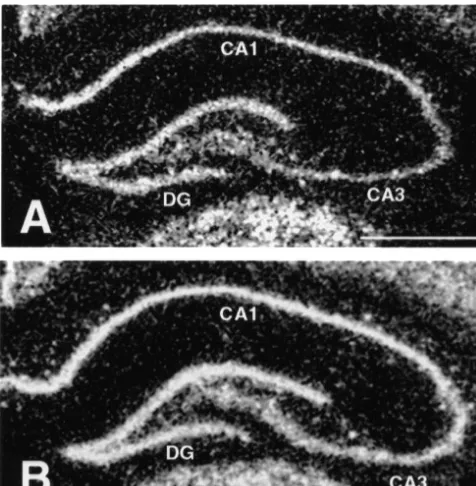Fig. 6. Relative expression levels of bgroups (3 mRNA in the medial parvocellu-lar (mpPVN) and posterior magnocellular (pmPVN) divisions of thehypothalamic paraventricular nucleus and in CA1 and CA3 hippocampalsubﬁelds and the dentate gyrus (DG) in chronically stressed and controln56/group).