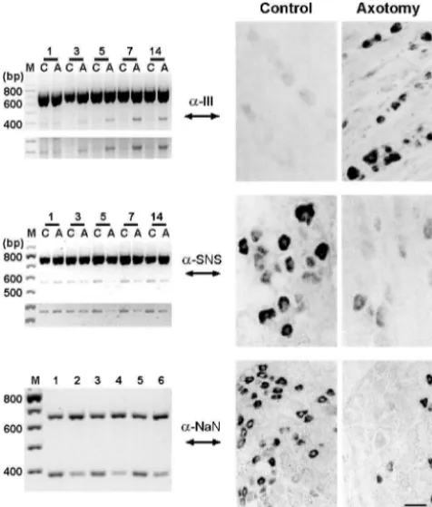 Fig. 6. In parallel with down-regulation of SNS and NaN channels, slowand persistent TTX-resistant sodium currents in small DRG neurons aredown-regulated following axonal transection within the sciatic nerve
