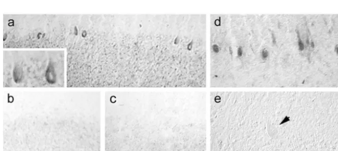 Fig. 8. Sensory Neuron Speciﬁc sodium channel SNS is not present within the normal cerebellum, but is expressed in cerebellar Purkinje cells withinbrains obtained at post-mortem from MS patients [6]