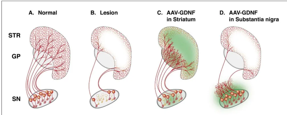 Fig. 5. Over-expression of GDNF in the striatum by intrastriatal injections of the AAV-GDNF vector can block dopamine neuron degeneration induced bythe intrastriatal 6-OHDA lesion, as illustrated in B and C