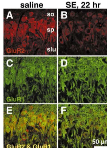 Fig. 9. Status epilepticus downregulates GluR2 subunit expression in CA3. (Upper) Co-localization of GluR1 and GluR2 immunoreactivity in CA3pyramidal neurons