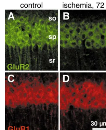 Fig. 5. Global ischemia induces downregulation of GluR2, but notGluR1, immunolabeling in CA1 pyramidal neurons