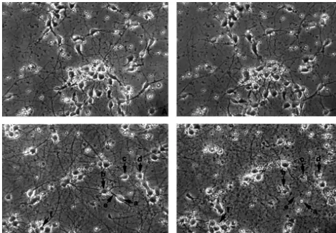 Fig. 2. Age-related glutamate neurotoxicity in cultured neocortical neurons. Photomicrographs from the same ﬁelds were taken before (left, A and C) andafter exposure (right, B and D) to glutamate for 4 h