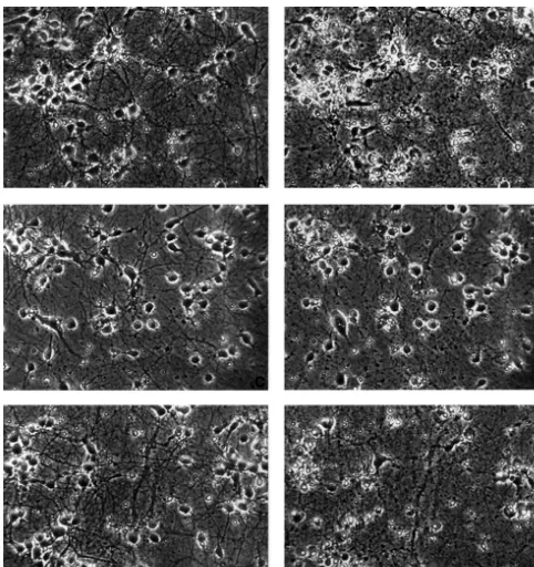 Fig. 6. Protective effect of DADLE against glutamate-induced neuronal injury. Photomicrographs of the same ﬁelds were taken before (left, (A), (C) and(E)) and after 4 h of cell treatment (right, (B), (D) and (F)) in 9-day cultures