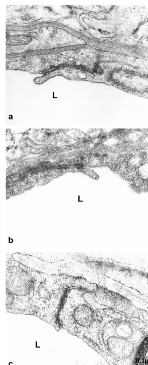 Fig. 1. Ultrathin section of a representative capillary in the cortex ofWKY (a), SHR (b) and SHRSP (c)