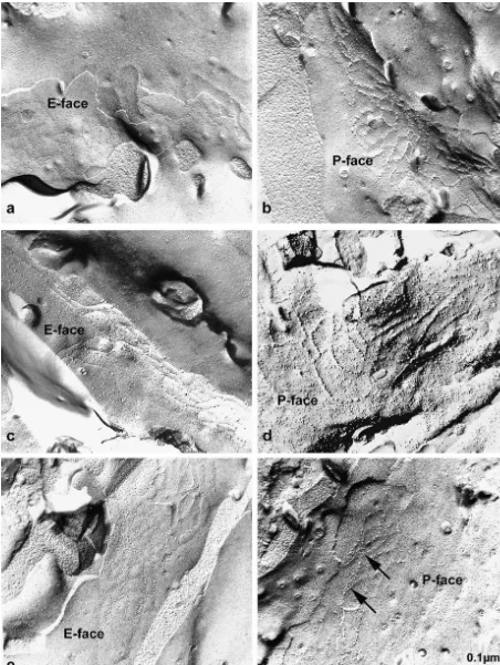 Fig. 2. Freeze-fracture electronmicrographs of tight junction strands in capillaries of cerebral cortices