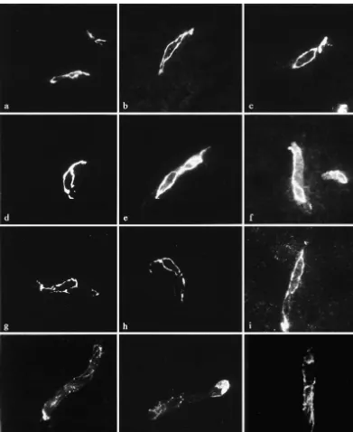 Fig. 3. Immunoreactivity of tight junction proteins in WKY (a, d, g, j), SHRSP (b, e, h, k) and SHR (c, f, i, l)