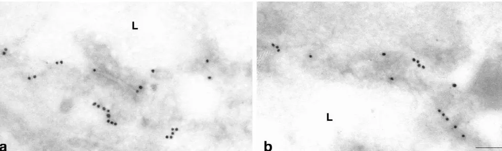 Fig. 5. Glut-1 immunoreactivity in cerebral capillaries of WKY (a) and SHRSP (b) demonstrated by immunogold labeling