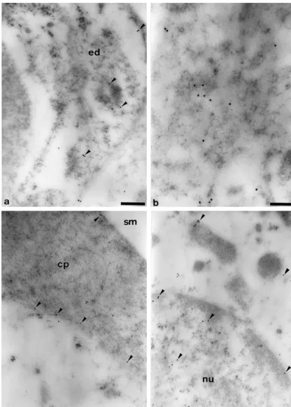 Fig. 1. Electron spectroscopic images of the elastically scattered electrons (DedGold-particles coupled to the anti-sGC E50 eV) of the second turn of the cochlea of the guinea pig