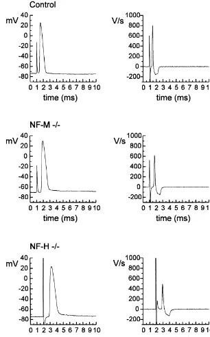 Fig. 3. Samples of typical intra-axonally recorded action potentials with corresponding differentiated values (dV/dt) (control, NF-M 2/2 and NF-H 2/2mice).
