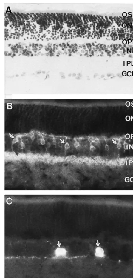 Fig. 1. Photomicrographs showing the laminar structure and localizationof TH-or NKR-like immunoreactivities in rat retina