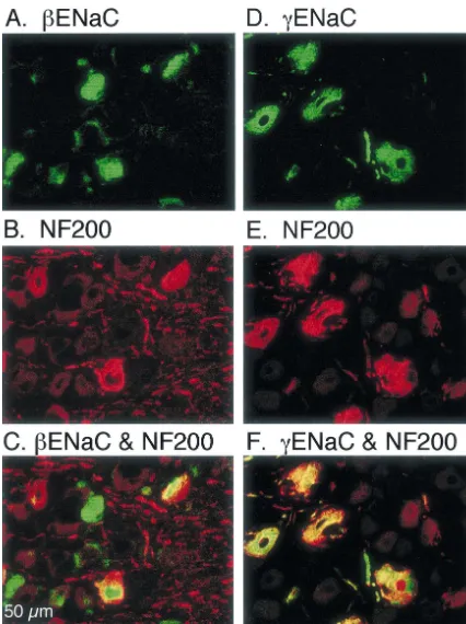 Fig. 2. Immunocytochemical detection of b and gENaC in medium and large DRG neurons. Cryosections (10 mm) of rat lumbar DRG were exposed toantibodies directed against bENaC (A), gENaC (D), or NF200 (B and E)