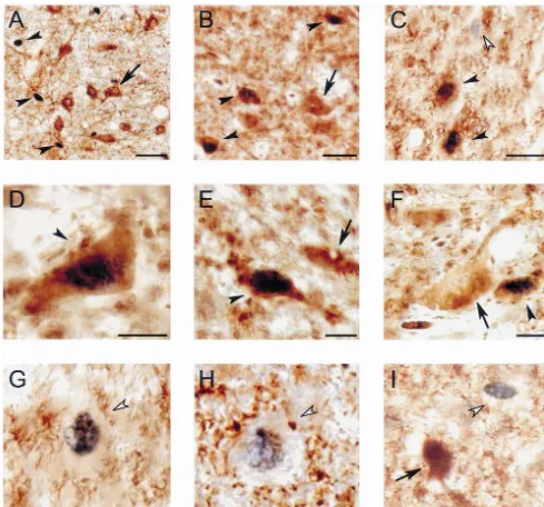 Fig. 1. Photomicrographs of the DRN illustrating serotonin, GABA and Fos immunoreactive neurons in AS-carbachol (A–H) and awake cats (I)