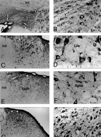 Fig. 1. Photomicrographs showing the immunoreactivity for NMDA receptor subunit NR1 in subdivisions of the vestibular nuclei