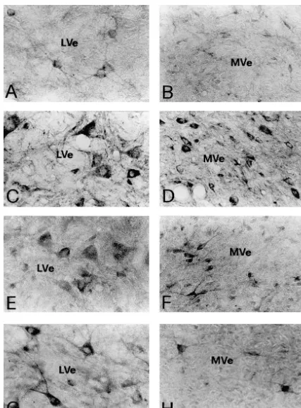 Fig. 4. Photomicrographs showing the immunoreactivity for GluR1 (A, B), GluR2 (C, D), GluR2/3 (E, F) and GluR4 (G, H) in the vestibular nuclei athigh magniﬁcation