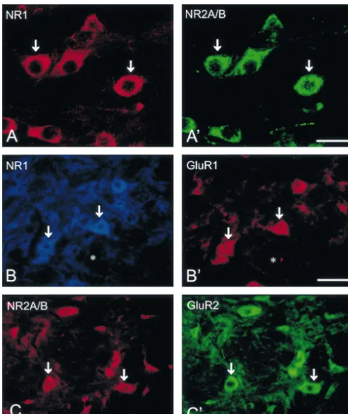 Fig. 5. Double immunoﬂuorescence showing the double labeled neurons with distinct glutamate receptor subunits, viz