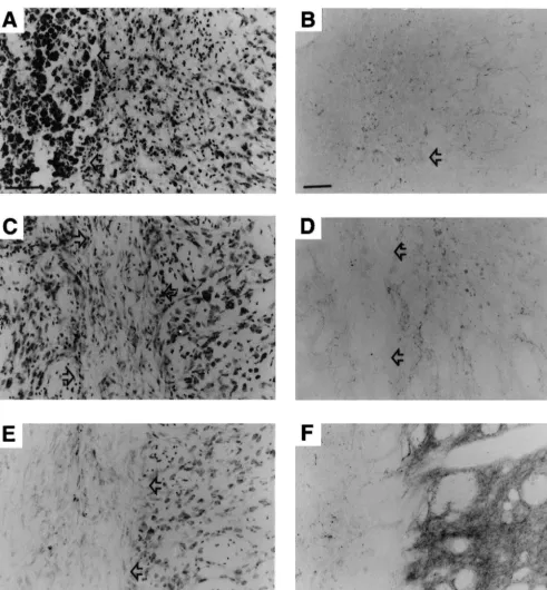 Fig. 2. Representative sections of the striatum from animals treated with burr hole only (A, B), b-gal-ﬁbroblasts (C, D), and FGF-2-ﬁbroblasts (E, F)