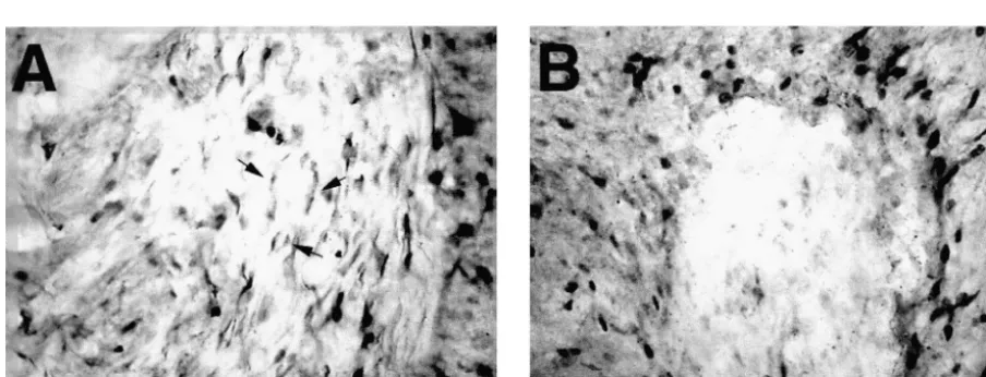 Fig. 6. Three striatal sections that were adjacent to those in which thedensity of TH-IR material had been measured were immunolabeled forGFAP, and area of intense gliosis was measured