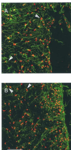 Fig. 8. An animals that received b-gal-ﬁbroblasts and was sacriﬁced 1 week later (A) or FGF-2-ﬁbroblasts and was sacriﬁced 5 weeks later (B) wereimmunolabeled for both FGF (red) and GFAP (green)
