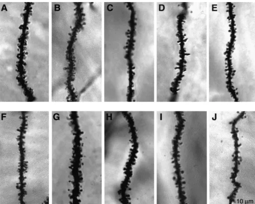 Fig. 2. Representative laser confocal photomicrographs illustrating segments of Golgi-impregnated secondary oblique dendrites within stratum radiatum ofarea CA1