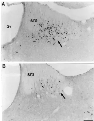Fig. 2. Induction of cindependently of other environmental factors produced increases in Fos expression in the habenular nucleus as compared to the control animal (B).Bar-fos, in the lateral habenular nucleus in an animal exposed to chronic-intermittent hy