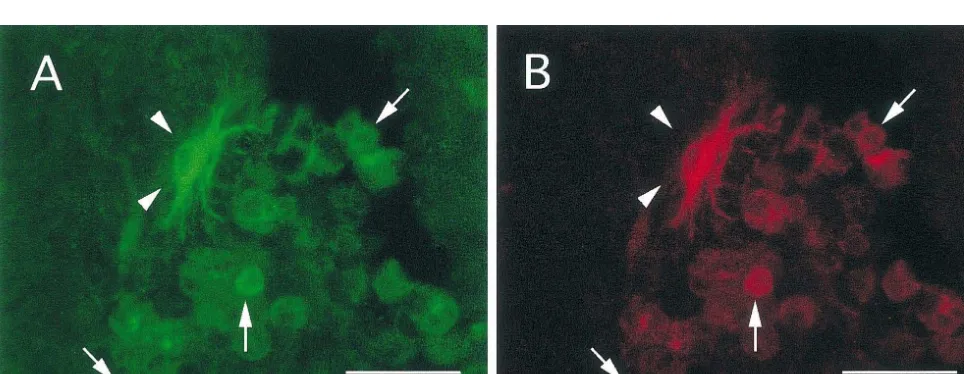 Fig. 1. Co-induction of HSP70 (A, C) and HO-1 (B, D) within the lesioned segment. HSP70 is co-localized with HO-1 in macrophages at 3 (A, B) and 14days (C, D) post injury