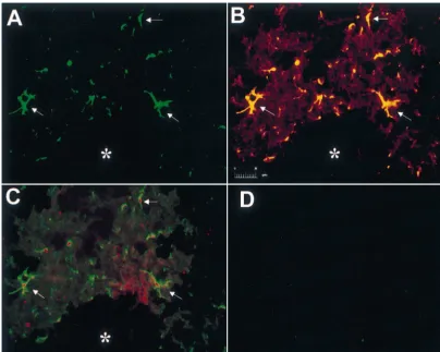 Fig. 4. Co-localization of VEGF in reactive astrocytes of GFAP:GFP transgenic mice. Photomicrograph (scale bar depicts 20 mm in length) demonstratingthe co-localization of reactive astrocytes and VEGF expression in GFAP:GFP transgenic mouse brains post-ste