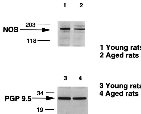 Fig. 4. Northern blot analysis of nNOS mRNA of the tissues obtained from young rats (lanes 1–3) and aged rats (lanes 4–6)