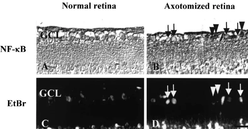 Fig. 3. Western blot analysis for translocation of NF-ktreatment 3 days after axotomy