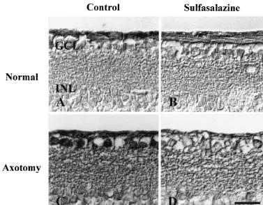 Fig. 4. Inhibition of NF-kB translocation by sulfasalazine 3 days after axotomy. (A) DMSO only; (B) sulfasalazine only; (C) DMSO treated axotomizedretina; and (D) sulfasalazine treated axotomized retina