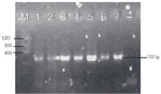 Gambar 1. Hasil elektroforesis produk PCR (amplikon) yang menggunakan gel