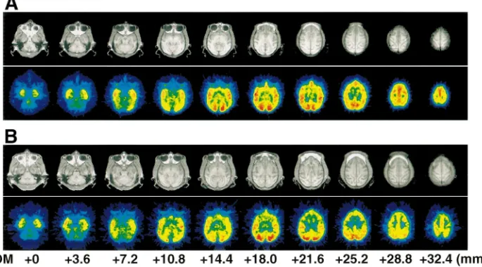 Fig. 1. MRI and PET images of [ C]MDL100,907 in the brains of young (A) and aged (B) conscious monkeys