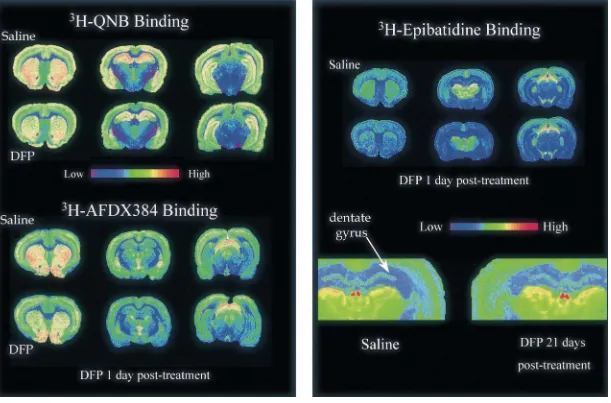 Fig. 1. Left panel: color-enhanced autoradiographs of [ H]QNB binding (primarily M1 subtype) and [ H]AFDX-384 binding (M2 subtype) to muscarinic cholinergic receptors in different levels of the33brain from rostral through caudal (left to right) sections in