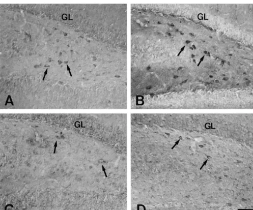 Fig. 1. Showing coronal sections of the dentate hilus of SR and SS gerbils. Compared to the case of SR (A), neurons in the dentate hilus, are stronglystained for SRIF in the pre-seizure group of SS gerbils (B, arrows)