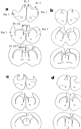 Fig. 1. Serial drawings of Golgi-Cox stained-coronal sections through the brain of representative rats with bilateral lesions of the motor cortex as adults(A), on postnatal day 10 (B), or postnatal day 1 (C and D)