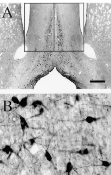 Fig. 1. Bright-ﬁeld photomicrographs showing ChAT-positive proﬁlesdetected in the MS at low (A) and high (B) power