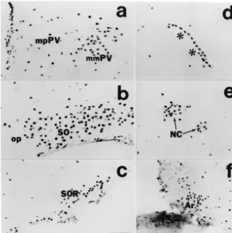 Fig. 2. Photomicrographs showing distribution of Fos-positive neurons in the paraventricular nucleus (a), principal part of the supraoptic nucleus (SO) (b),retrochiasmatic supraoptic nucleus (SOR) (c), lateral hypothalamic perivascular nucleus (d), circula