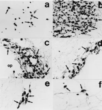 Fig. 4. Photomicrographs showing distribution of Fos/vasopressin double-labeled neurons in the anterior parvicellular part of the paraventricular nucleus(a), lateral magnocellular part of the paraventricular nucleus (b), principal part of the supraoptic nu