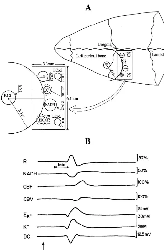 Fig. 1. (A) Schematic presentation of the special multiprobe assembly (MPA) developed in order to study the responses to cortical spreading depression.The right side shows the MPA located on the cerebral cortex